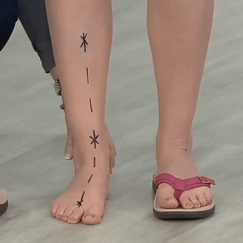 Sigrid | Sandales d'été orthopédiques